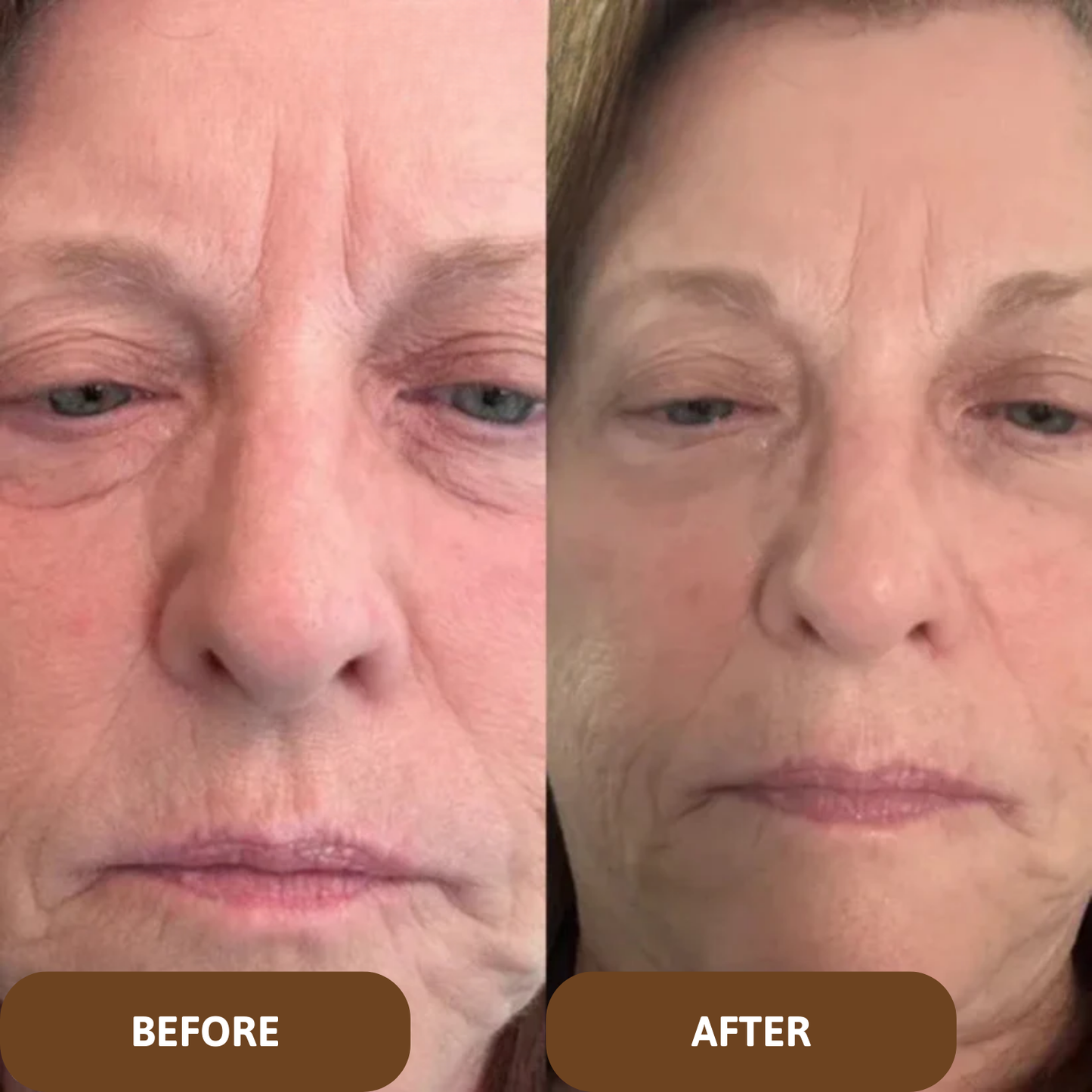 LumineSkin® Calcium Multi Balm